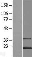 Western blot validation of overexpression lysate (Cat# LY404004) using anti-DDK antibody (Cat# TA50011-100). Left: Cell lysates from un-transfected HEK293T cells; Right: Cell lysates from HEK293T cells transfected with RC219195 using transfection reagent MegaTran 2.0 (Cat# TT210002).