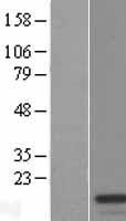 Western blot validation of overexpression lysate (Cat# LY421828) using anti-DDK antibody (Cat# TA50011-100). Left: Cell lysates from un-transfected HEK293T cells; Right: Cell lysates from HEK293T cells transfected with RC212341 using transfection reagent MegaTran 2.0 (Cat# TT210002).