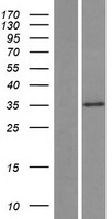Western blot validation of overexpression lysate (Cat# LY423200) using anti-DDK antibody (Cat# TA50011-100). Left: Cell lysates from un-transfected HEK293T cells; Right: Cell lysates from HEK293T cells transfected with RC212728 using transfection reagent MegaTran 2.0 (Cat# TT210002).