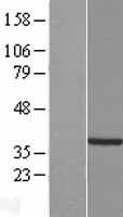 Western blot validation of overexpression lysate (Cat# LY421890) using anti-DDK antibody (Cat# TA50011-100). Left: Cell lysates from un-transfected HEK293T cells; Right: Cell lysates from HEK293T cells transfected with RC212399 using transfection reagent MegaTran 2.0 (Cat# TT210002).