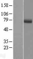 Western blot validation of overexpression lysate (Cat# LY405007) using anti-DDK antibody (Cat# TA50011-100). Left: Cell lysates from un-transfected HEK293T cells; Right: Cell lysates from HEK293T cells transfected with RC221392 using transfection reagent MegaTran 2.0 (Cat# TT210002).