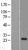 Western blot validation of overexpression lysate (Cat# LY422938) using anti-DDK antibody (Cat# TA50011-100). Left: Cell lysates from un-transfected HEK293T cells; Right: Cell lysates from HEK293T cells transfected with RC215855 using transfection reagent MegaTran 2.0 (Cat# TT210002).