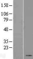 Western blot validation of overexpression lysate (Cat# LY406234) using anti-DDK antibody (Cat# TA50011-100). Left: Cell lysates from un-transfected HEK293T cells; Right: Cell lysates from HEK293T cells transfected with RC218560 using transfection reagent MegaTran 2.0 (Cat# TT210002).