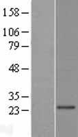 Western blot validation of overexpression lysate (Cat# LY406386) using anti-DDK antibody (Cat# TA50011-100). Left: Cell lysates from un-transfected HEK293T cells; Right: Cell lysates from HEK293T cells transfected with RC222158 using transfection reagent MegaTran 2.0 (Cat# TT210002).
