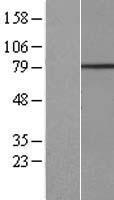 Western blot validation of overexpression lysate (Cat# LY404945) using anti-DDK antibody (Cat# TA50011-100). Left: Cell lysates from un-transfected HEK293T cells; Right: Cell lysates from HEK293T cells transfected with RC218148 using transfection reagent MegaTran 2.0 (Cat# TT210002).