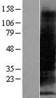 Western blot validation of overexpression lysate (Cat# LY416964) using anti-DDK antibody (Cat# TA50011-100). Left: Cell lysates from un-transfected HEK293T cells; Right: Cell lysates from HEK293T cells transfected with RC218275 using transfection reagent MegaTran 2.0 (Cat# TT210002).
