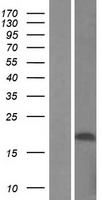 Western blot validation of overexpression lysate (Cat# LY405535) using anti-DDK antibody (Cat# TA50011-100). Left: Cell lysates from un-transfected HEK293T cells; Right: Cell lysates from HEK293T cells transfected with RC220934 using transfection reagent MegaTran 2.0 (Cat# TT210002).