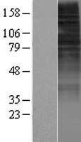 Western blot validation of overexpression lysate (Cat# LY415591) using anti-DDK antibody (Cat# TA50011-100). Left: Cell lysates from un-transfected HEK293T cells; Right: Cell lysates from HEK293T cells transfected with RC221691 using transfection reagent MegaTran 2.0 (Cat# TT210002).