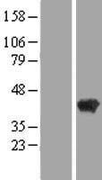 Western blot validation of overexpression lysate (Cat# LY416512) using anti-DDK antibody (Cat# TA50011-100). Left: Cell lysates from un-transfected HEK293T cells; Right: Cell lysates from HEK293T cells transfected with RC219319 using transfection reagent MegaTran 2.0 (Cat# TT210002).