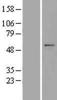 Western blot validation of overexpression lysate (Cat# LY408538) using anti-DDK antibody (Cat# TA50011-100). Left: Cell lysates from un-transfected HEK293T cells; Right: Cell lysates from HEK293T cells transfected with RC213582 using transfection reagent MegaTran 2.0 (Cat# TT210002).