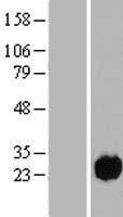Western blot validation of overexpression lysate (Cat# LY409459) using anti-DDK antibody (Cat# TA50011-100). Left: Cell lysates from un-transfected HEK293T cells; Right: Cell lysates from HEK293T cells transfected with RC222104 using transfection reagent MegaTran 2.0 (Cat# TT210002).