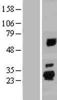 Western blot validation of overexpression lysate (Cat# LY430677) using anti-DDK antibody (Cat# TA50011-100). Left: Cell lysates from un-transfected HEK293T cells; Right: Cell lysates from HEK293T cells transfected with RC226669 using transfection reagent MegaTran 2.0 (Cat# TT210002).