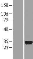 Western blot validation of overexpression lysate (Cat# LY411596) using anti-DDK antibody (Cat# TA50011-100). Left: Cell lysates from un-transfected HEK293T cells; Right: Cell lysates from HEK293T cells transfected with RC221465 using transfection reagent MegaTran 2.0 (Cat# TT210002).