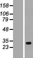 Western blot validation of overexpression lysate (Cat# LY421226) using anti-DDK antibody (Cat# TA50011-100). Left: Cell lysates from un-transfected HEK293T cells; Right: Cell lysates from HEK293T cells transfected with RC224843 using transfection reagent MegaTran 2.0 (Cat# TT210002).