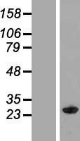 Western blot validation of overexpression lysate (Cat# LY413934) using anti-DDK antibody (Cat# TA50011-100). Left: Cell lysates from un-transfected HEK293T cells; Right: Cell lysates from HEK293T cells transfected with RC212668 using transfection reagent MegaTran 2.0 (Cat# TT210002).