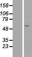 Western blot validation of overexpression lysate (Cat# LY411383) using anti-DDK antibody (Cat# TA50011-100). Left: Cell lysates from un-transfected HEK293T cells; Right: Cell lysates from HEK293T cells transfected with RC219786 using transfection reagent MegaTran 2.0 (Cat# TT210002).