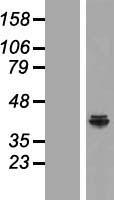 Western blot validation of overexpression lysate (Cat# LY411352) using anti-DDK antibody (Cat# TA50011-100). Left: Cell lysates from un-transfected HEK293T cells; Right: Cell lysates from HEK293T cells transfected with RC217112 using transfection reagent MegaTran 2.0 (Cat# TT210002).