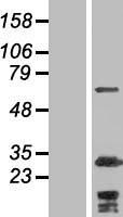 Western blot validation of overexpression lysate (Cat# LY410386) using anti-DDK antibody (Cat# TA50011-100). Left: Cell lysates from un-transfected HEK293T cells; Right: Cell lysates from HEK293T cells transfected with RC217905 using transfection reagent MegaTran 2.0 (Cat# TT210002).
