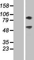 Western blot validation of overexpression lysate (Cat# LY428459) using anti-DDK antibody (Cat# TA50011-100). Left: Cell lysates from un-transfected HEK293T cells; Right: Cell lysates from HEK293T cells transfected with RC226540 using transfection reagent MegaTran 2.0 (Cat# TT210002).
