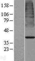 Western blot validation of overexpression lysate (Cat# LY405561) using anti-DDK antibody (Cat# TA50011-100). Left: Cell lysates from un-transfected HEK293T cells; Right: Cell lysates from HEK293T cells transfected with RC224159 using transfection reagent MegaTran 2.0 (Cat# TT210002).