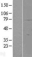 Western blot validation of overexpression lysate (Cat# LY411338) using anti-DDK antibody (Cat# TA50011-100). Left: Cell lysates from un-transfected HEK293T cells; Right: Cell lysates from HEK293T cells transfected with RC223257 using transfection reagent MegaTran 2.0 (Cat# TT210002).