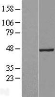 Western blot validation of overexpression lysate (Cat# LY412890) using anti-DDK antibody (Cat# TA50011-100). Left: Cell lysates from un-transfected HEK293T cells; Right: Cell lysates from HEK293T cells transfected with RC211962 using transfection reagent MegaTran 2.0 (Cat# TT210002).