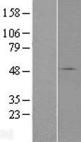 Western blot validation of overexpression lysate (Cat# LY410238) using anti-DDK antibody (Cat# TA50011-100). Left: Cell lysates from un-transfected HEK293T cells; Right: Cell lysates from HEK293T cells transfected with RC215818 using transfection reagent MegaTran 2.0 (Cat# TT210002).