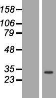 Western blot validation of overexpression lysate (Cat# LY415781) using anti-DDK antibody (Cat# TA50011-100). Left: Cell lysates from un-transfected HEK293T cells; Right: Cell lysates from HEK293T cells transfected with RC215880 using transfection reagent MegaTran 2.0 (Cat# TT210002).