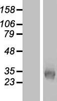 Western blot validation of overexpression lysate (Cat# LY409584) using anti-DDK antibody (Cat# TA50011-100). Left: Cell lysates from un-transfected HEK293T cells; Right: Cell lysates from HEK293T cells transfected with RC218633 using transfection reagent MegaTran 2.0 (Cat# TT210002).
