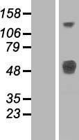 Western blot validation of overexpression lysate (Cat# LY412312) using anti-DDK antibody (Cat# TA50011-100). Left: Cell lysates from un-transfected HEK293T cells; Right: Cell lysates from HEK293T cells transfected with RC220980 using transfection reagent MegaTran 2.0 (Cat# TT210002).
