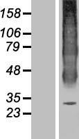 Western blot validation of overexpression lysate (Cat# LY419821) using anti-DDK antibody (Cat# TA50011-100). Left: Cell lysates from un-transfected HEK293T cells; Right: Cell lysates from HEK293T cells transfected with RC215710 using transfection reagent MegaTran 2.0 (Cat# TT210002).