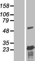 Western blot validation of overexpression lysate (Cat# LY403894) using anti-DDK antibody (Cat# TA50011-100). Left: Cell lysates from un-transfected HEK293T cells; Right: Cell lysates from HEK293T cells transfected with RC221221 using transfection reagent MegaTran 2.0 (Cat# TT210002).