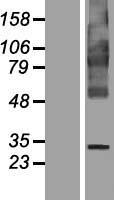 Western blot validation of overexpression lysate (Cat# LY404341) using anti-DDK antibody (Cat# TA50011-100). Left: Cell lysates from un-transfected HEK293T cells; Right: Cell lysates from HEK293T cells transfected with RC213367 using transfection reagent MegaTran 2.0 (Cat# TT210002).