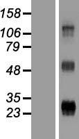 Western blot validation of overexpression lysate (Cat# LY409156) using anti-DDK antibody (Cat# TA50011-100). Left: Cell lysates from un-transfected HEK293T cells; Right: Cell lysates from HEK293T cells transfected with RC222831 using transfection reagent MegaTran 2.0 (Cat# TT210002).