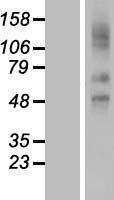 Western blot validation of overexpression lysate (Cat# LY417162) using anti-DDK antibody (Cat# TA50011-100). Left: Cell lysates from un-transfected HEK293T cells; Right: Cell lysates from HEK293T cells transfected with RC207910 using transfection reagent MegaTran 2.0 (Cat# TT210002).