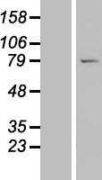 Western blot validation of overexpression lysate (Cat# LY413603) using anti-DDK antibody (Cat# TA50011-100). Left: Cell lysates from un-transfected HEK293T cells; Right: Cell lysates from HEK293T cells transfected with RC207740 using transfection reagent MegaTran 2.0 (Cat# TT210002).