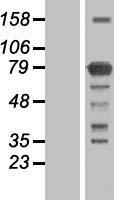 Western blot validation of overexpression lysate (Cat# LY414636) using anti-DDK antibody (Cat# TA50011-100). Left: Cell lysates from un-transfected HEK293T cells; Right: Cell lysates from HEK293T cells transfected with RC206738 using transfection reagent MegaTran 2.0 (Cat# TT210002).