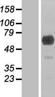 Western blot validation of overexpression lysate (Cat# LY405275) using anti-DDK antibody (Cat# TA50011-100). Left: Cell lysates from un-transfected HEK293T cells; Right: Cell lysates from HEK293T cells transfected with RC207415 using transfection reagent MegaTran 2.0 (Cat# TT210002).