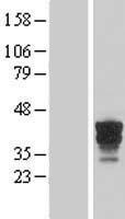 Western blot validation of overexpression lysate (Cat# LY415107) using anti-DDK antibody (Cat# TA50011-100). Left: Cell lysates from un-transfected HEK293T cells; Right: Cell lysates from HEK293T cells transfected with RC222801 using transfection reagent MegaTran 2.0 (Cat# TT210002).