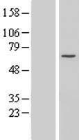 Western blot validation of overexpression lysate (Cat# LY405892) using anti-DDK antibody (Cat# TA50011-100). Left: Cell lysates from un-transfected HEK293T cells; Right: Cell lysates from HEK293T cells transfected with RC206961 using transfection reagent MegaTran 2.0 (Cat# TT210002).