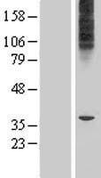 Western blot validation of overexpression lysate (Cat# LY407405) using anti-DDK antibody (Cat# TA50011-100). Left: Cell lysates from un-transfected HEK293T cells; Right: Cell lysates from HEK293T cells transfected with RC206154 using transfection reagent MegaTran 2.0 (Cat# TT210002).