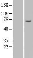 Western blot validation of overexpression lysate (Cat# LY411045) using anti-DDK antibody (Cat# TA50011-100). Left: Cell lysates from un-transfected HEK293T cells; Right: Cell lysates from HEK293T cells transfected with RC207882 using transfection reagent MegaTran 2.0 (Cat# TT210002).