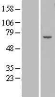 Western blot validation of overexpression lysate (Cat# LY408803) using anti-DDK antibody (Cat# TA50011-100). Left: Cell lysates from un-transfected HEK293T cells; Right: Cell lysates from HEK293T cells transfected with RC207632 using transfection reagent MegaTran 2.0 (Cat# TT210002).