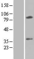 Western blot validation of overexpression lysate (Cat# LY412610) using anti-DDK antibody (Cat# TA50011-100). Left: Cell lysates from un-transfected HEK293T cells; Right: Cell lysates from HEK293T cells transfected with RC207494 using transfection reagent MegaTran 2.0 (Cat# TT210002).
