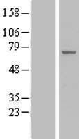 Western blot validation of overexpression lysate (Cat# LY414196) using anti-DDK antibody (Cat# TA50011-100). Left: Cell lysates from un-transfected HEK293T cells; Right: Cell lysates from HEK293T cells transfected with RC206690 using transfection reagent MegaTran 2.0 (Cat# TT210002).