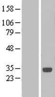 Western blot validation of overexpression lysate (Cat# LY422980) using anti-DDK antibody (Cat# TA50011-100). Left: Cell lysates from un-transfected HEK293T cells; Right: Cell lysates from HEK293T cells transfected with RC206634 using transfection reagent MegaTran 2.0 (Cat# TT210002).