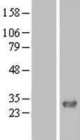 Western blot validation of overexpression lysate (Cat# LY408210) using anti-DDK antibody (Cat# TA50011-100). Left: Cell lysates from un-transfected HEK293T cells; Right: Cell lysates from HEK293T cells transfected with RC206625 using transfection reagent MegaTran 2.0 (Cat# TT210002).