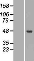 Western blot validation of overexpression lysate (Cat# LY419848) using anti-DDK antibody (Cat# TA50011-100). Left: Cell lysates from un-transfected HEK293T cells; Right: Cell lysates from HEK293T cells transfected with RC204465 using transfection reagent MegaTran 2.0 (Cat# TT210002).