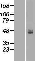 Western blot validation of overexpression lysate (Cat# LY414025) using anti-DDK antibody (Cat# TA50011-100). Left: Cell lysates from un-transfected HEK293T cells; Right: Cell lysates from HEK293T cells transfected with RC202269 using transfection reagent MegaTran 2.0 (Cat# TT210002).