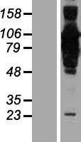 Western blot validation of overexpression lysate (Cat# LY411567) using anti-DDK antibody (Cat# TA50011-100). Left: Cell lysates from un-transfected HEK293T cells; Right: Cell lysates from HEK293T cells transfected with RC209507 using transfection reagent MegaTran 2.0 (Cat# TT210002).